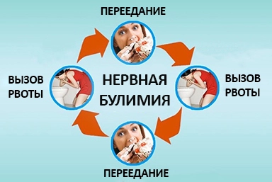 Лечение булимии в Гомеле
